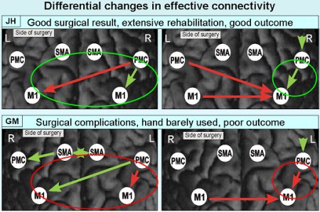 Differential changes